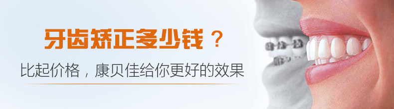牙齿矫正要多少钱